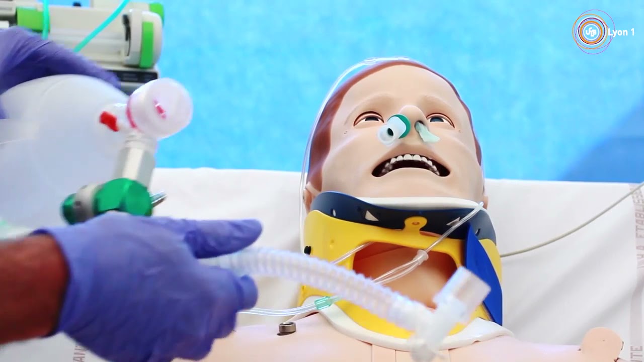 Intubation tracheale fibroscopique vigile