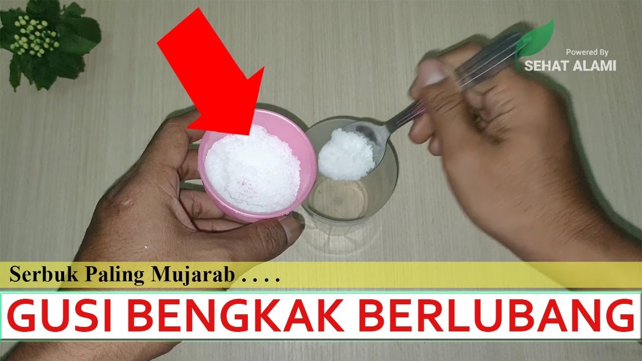Cara Cepat Mengobati Gusi Bengkak dan Gigi Berlubang Secara Alami