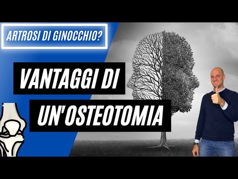 Anteprima video YouTube