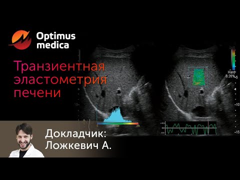 Мастер класс: "Тразиентная эластометрия печени на аппарате эксперт класса Fujifilm Arietta 65".