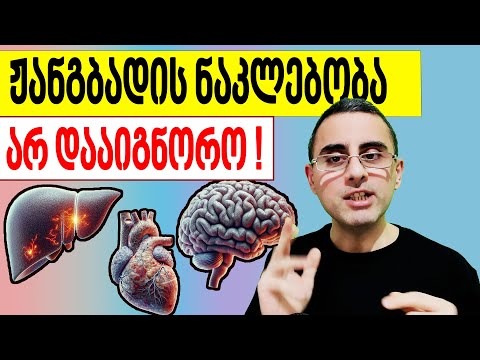 სისხლის მიმოქცევის დარღვევის 6 ნიშანი!