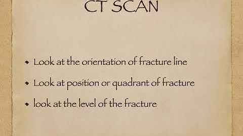 Radiology of Acetabular Fracture - Simplified!