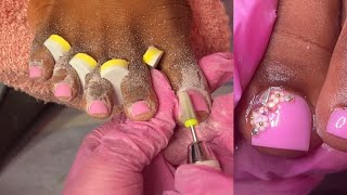 Acrylic toes without tips/forms | acrylic overlay on toes