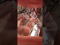 ASMR Eye Cleaning &amp; Ice Water Treatment 💧 Cooling Triggers for Sleep