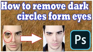 How To Remove Dark Circles Under Eyes In Photoshop | 1Minute Photoshop Remove Dark Circles Naturally