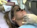 Dr. Michael Gold Speaks about the LightPod Era 2940nm Laser by Aerolase