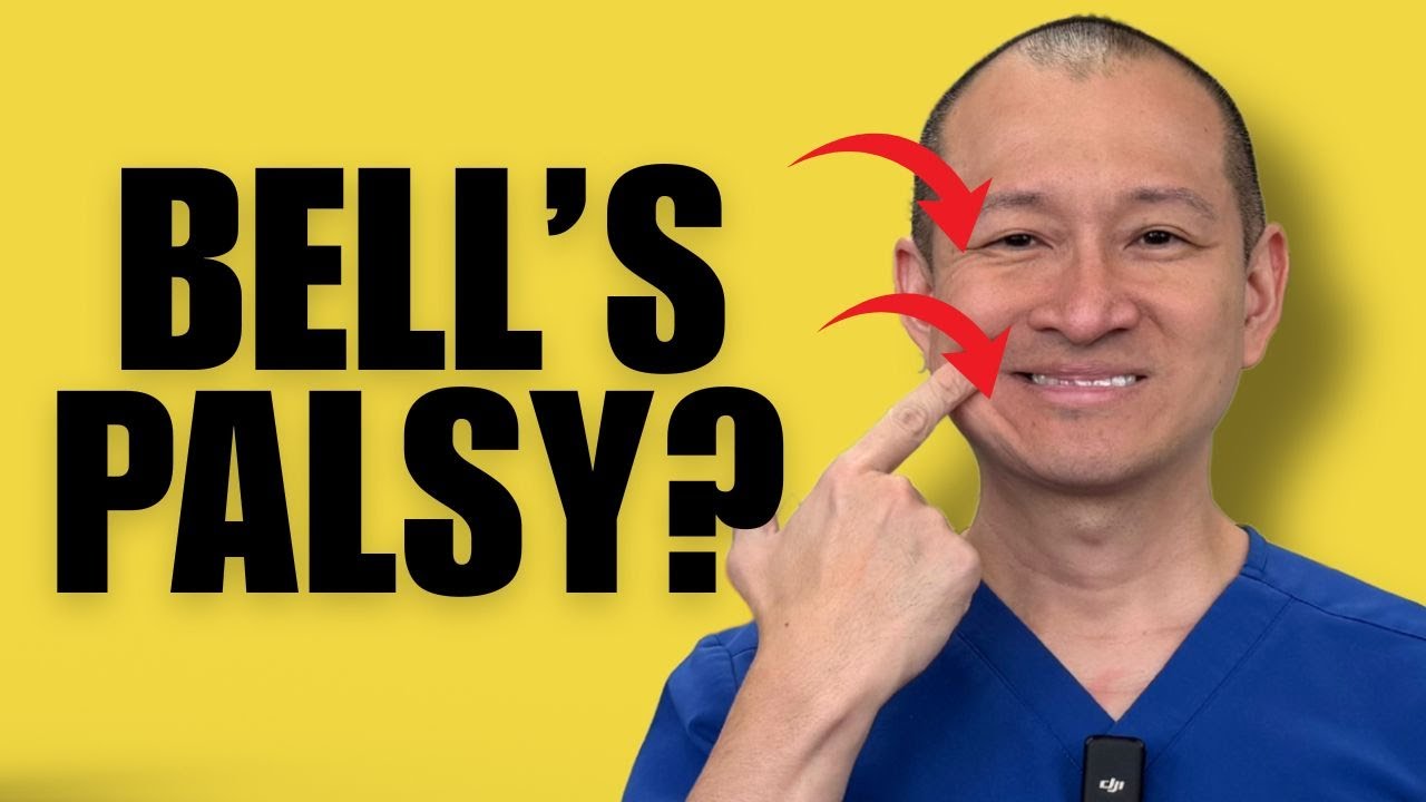 Facial Exercises For Bell’s Palsy