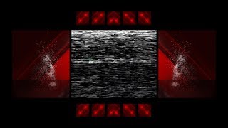IIVII - YOU DIE