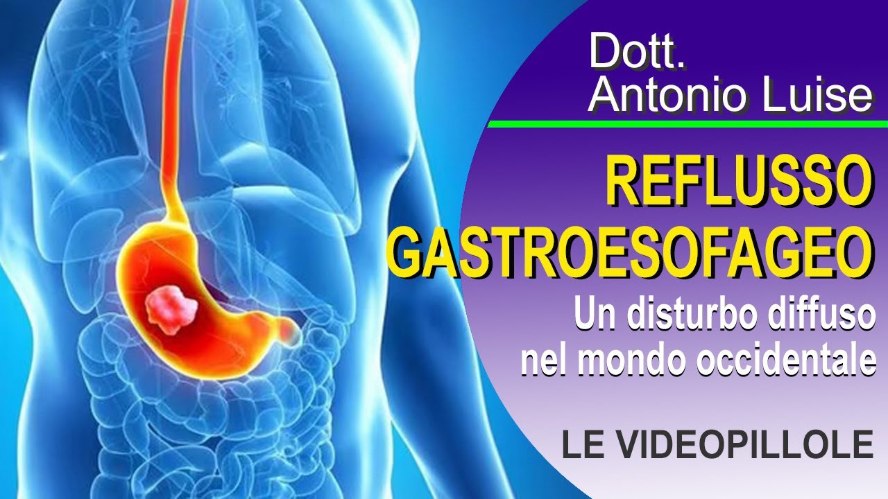 REFLUSSO GASTROESOFAGEO