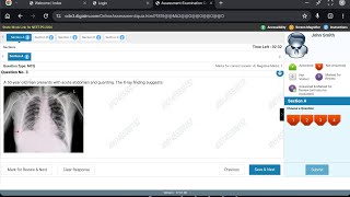 NBEMS NEET PG 2026 mock test- General instructions and guidance. How to solve MCQs