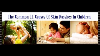 Common 11 Causes of Skin Rashes