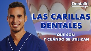 Todo sobre CARILLAS dentales - COMPOSITE vs PORCELANA: ¿Qué opción es mejor? | Dentalk! ©