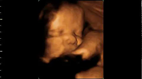 BABY BOY Carroll Burton 35 WEEKS.avi