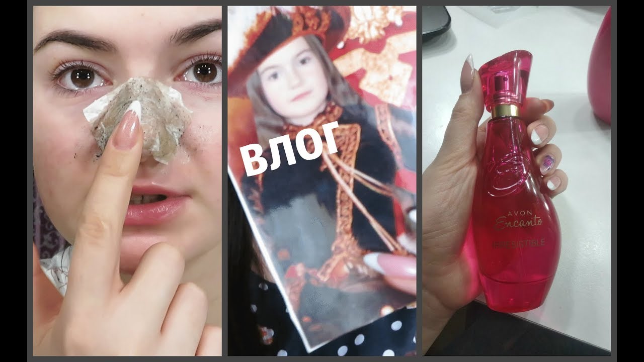 Чистка носа от черных точек/Мои детские фото , какая я была/молодые ...