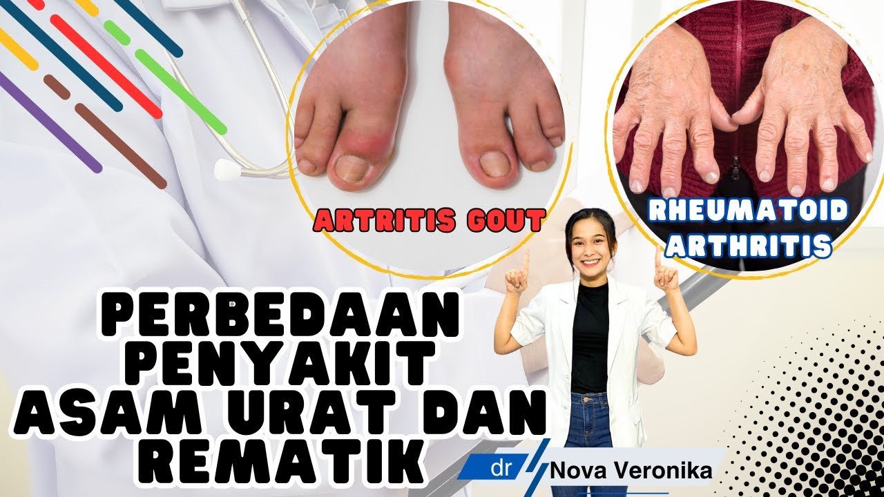 Perbedaan penyakit asam urat dan rematik #asamurat #rematik