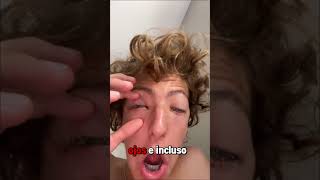 “Este chico se despertó con los ojos pegados 😱👀”