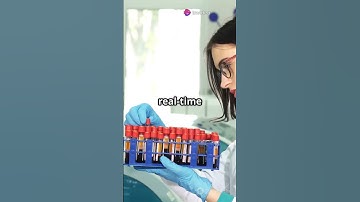 AI Revolutionizing Early Disease DetectiON