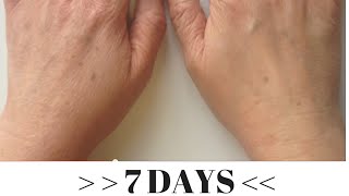 Proskins Gold Anti-Aging Gloves Before and After