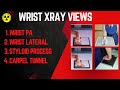 WRIST XRAY || WRIST PA ,LATERAL || STYLOID PROCESS || CARPEL TUNNEL|| CARPEL XRAY || RADIOGRAPHY ||