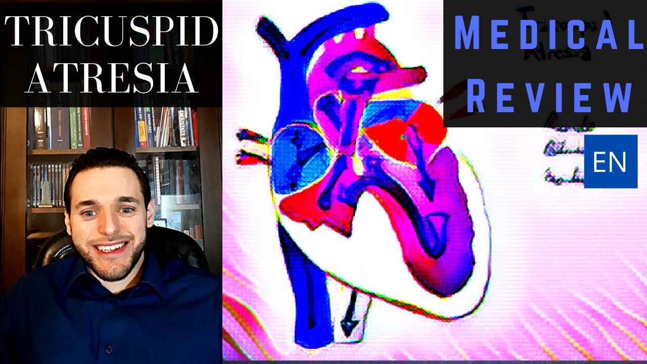 Понимание атрезии трехстворчатого клапана