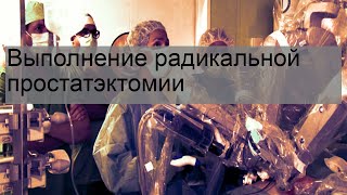 Выполнение радикальной простатэктомии