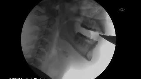 Chapter 2: 04 EMBOUCHURE: Subtone