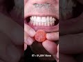 The Most Satisfying Chocolate and Candy ASMR Compilation 🍫🍬 #DoctorTristanPeh #Chocolate #Candy