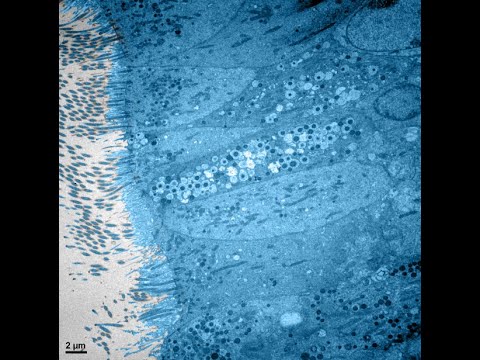 Vidéo: Des Scientifiques De Saint-Pétersbourg Ont Testé Un Nouveau Médicament Contre Le Cancer - Vue Alternative