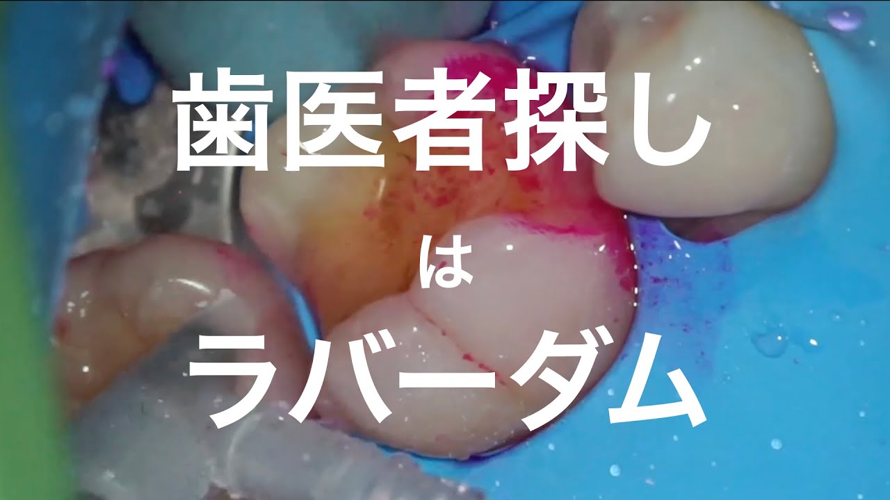 歯医者の探しはラバーダム防湿をしているか