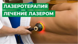 Физиотерапия: лазеротерапия. Лечение лазером.