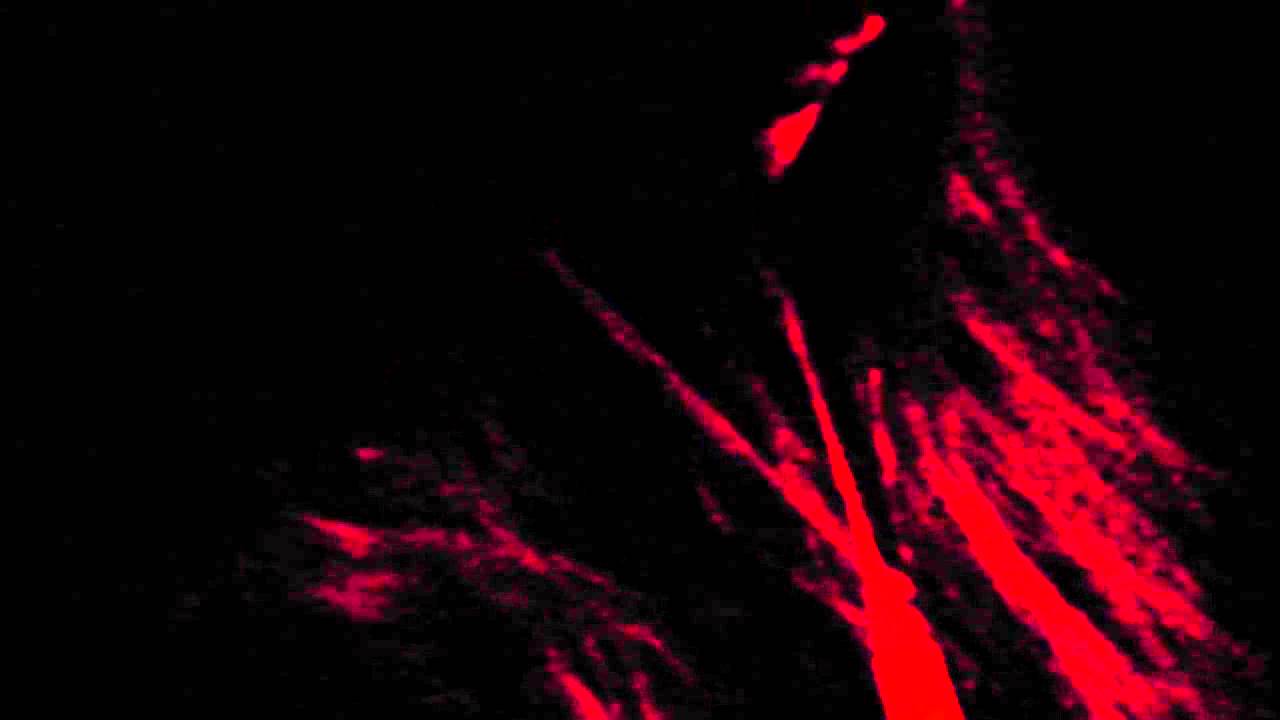 Asylum Lake paranormal investigation part 1