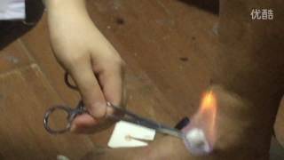 Chinese FIRE needling treatment - Fire acupuncture