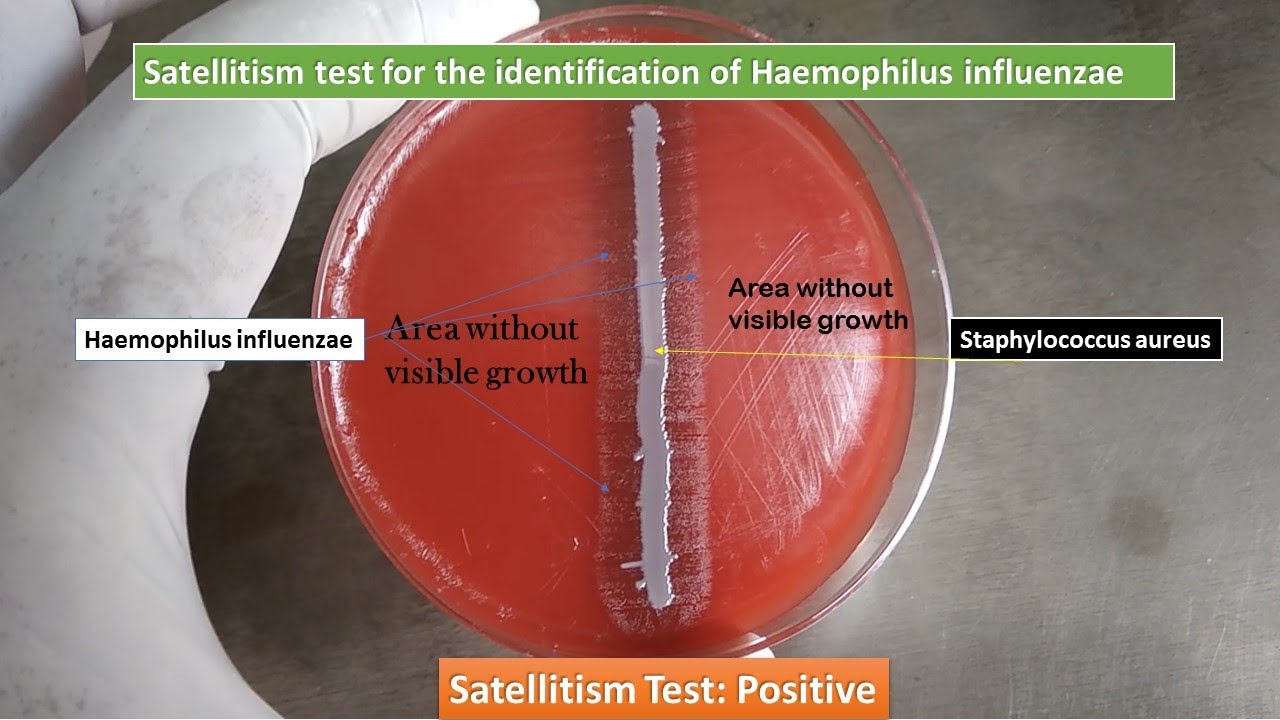 Satellitism Test for Identification of Haemophilus influenzae