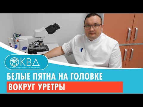 😯 Белые пятна на головке вокруг уретры. Клинический случай №592