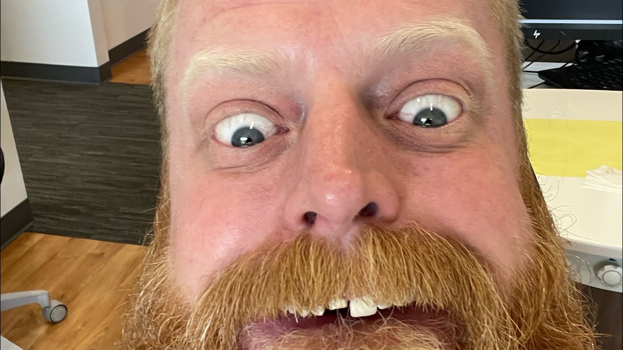 How to connect the Scarlett and the Analog receiver to the computer