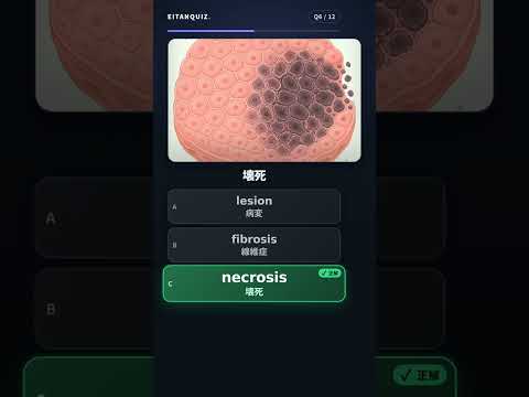 epilepsy の英単語解説動画