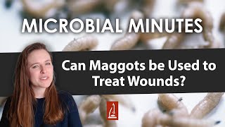 Maggot Therapy for Treating Wounds