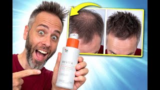 Best Volumizing Shampoo for Thin Hair