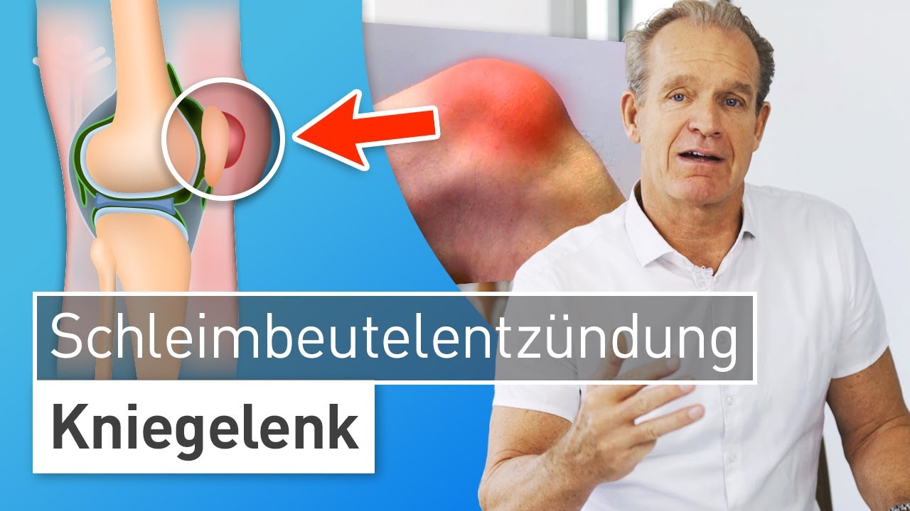 Schwellung Am Knie Seitlich Außen Ohne Schmerzen www.youtube.com