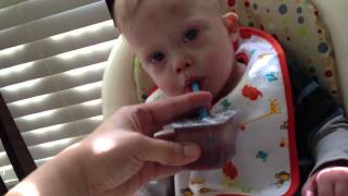 Baby With Down Syndrome Learning How To Drink From a Straw