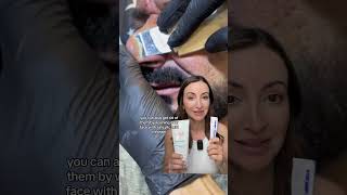 Shocking Intense Nose Extraction Sebaceous Filaments Removal Reaction Video