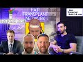 Hair transplants max density with ai repairs verteporfin trial dr ted miln