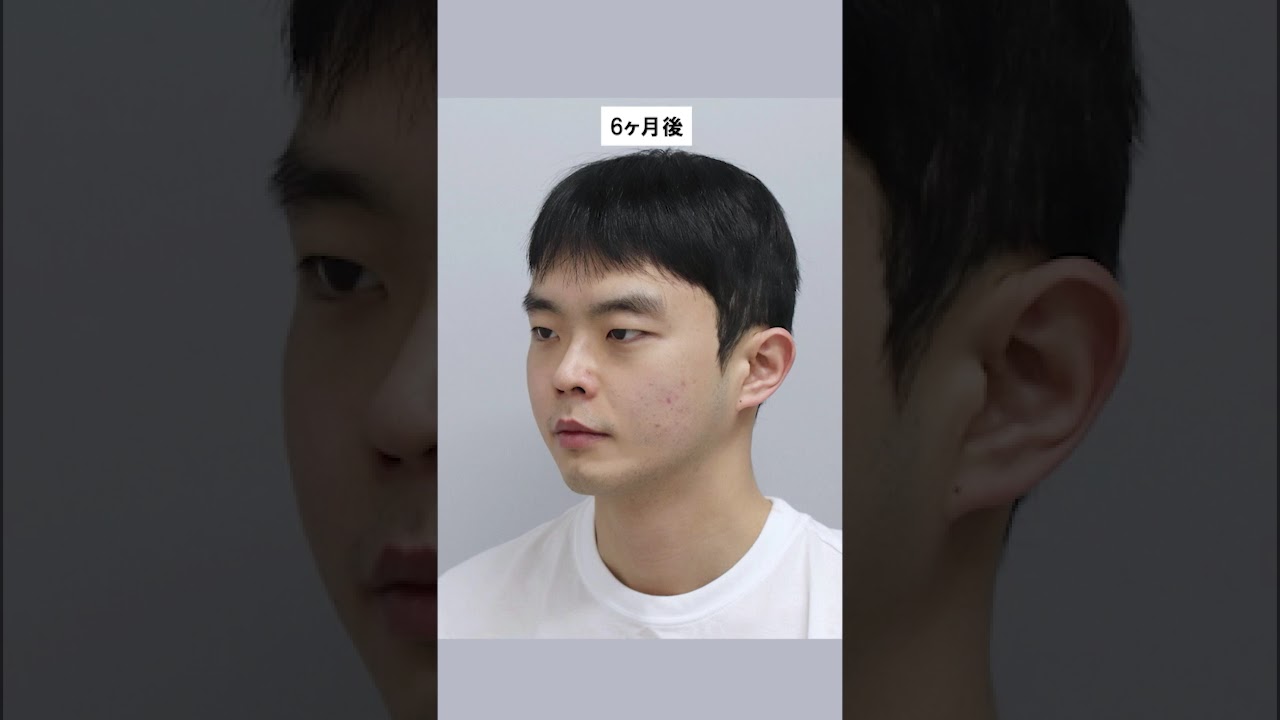 등록한썸네일