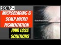 SCALP MICROPIGMENTATION AND SCALP MICROBLADING - HAIR LOSS SOLUTIONS FOR WOMEN AND MEN