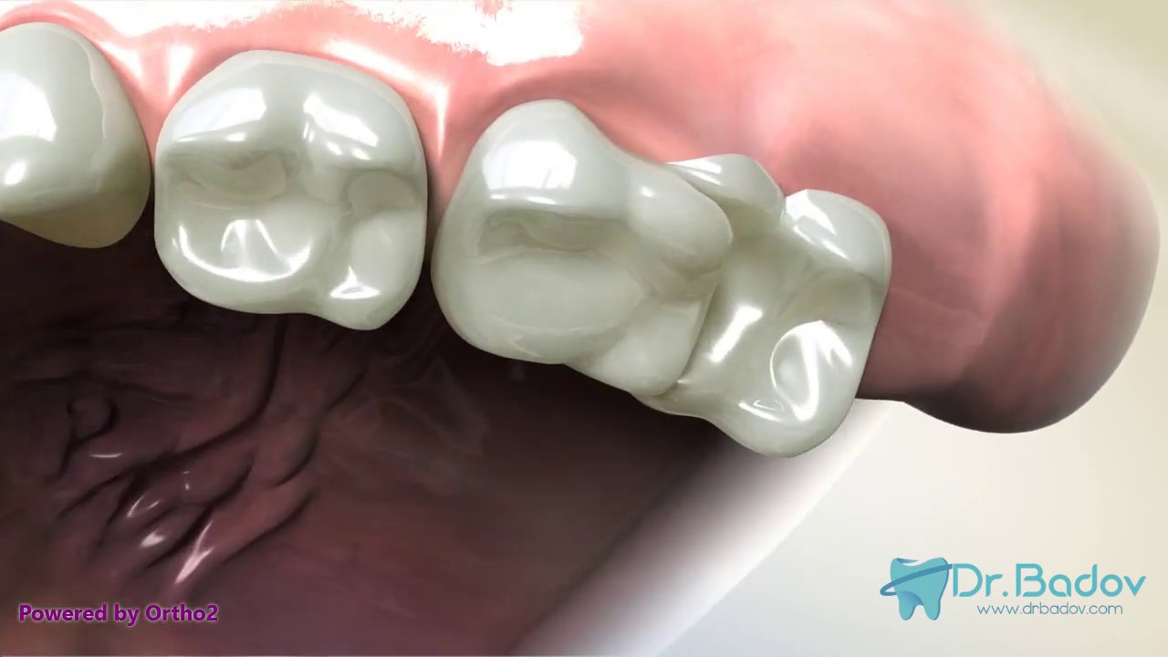 #ортодонт #брекети #консултация Първа консултация с ортодонт- какво трябва да знаем и защо е важна?