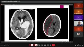 Neurología, Clase 1