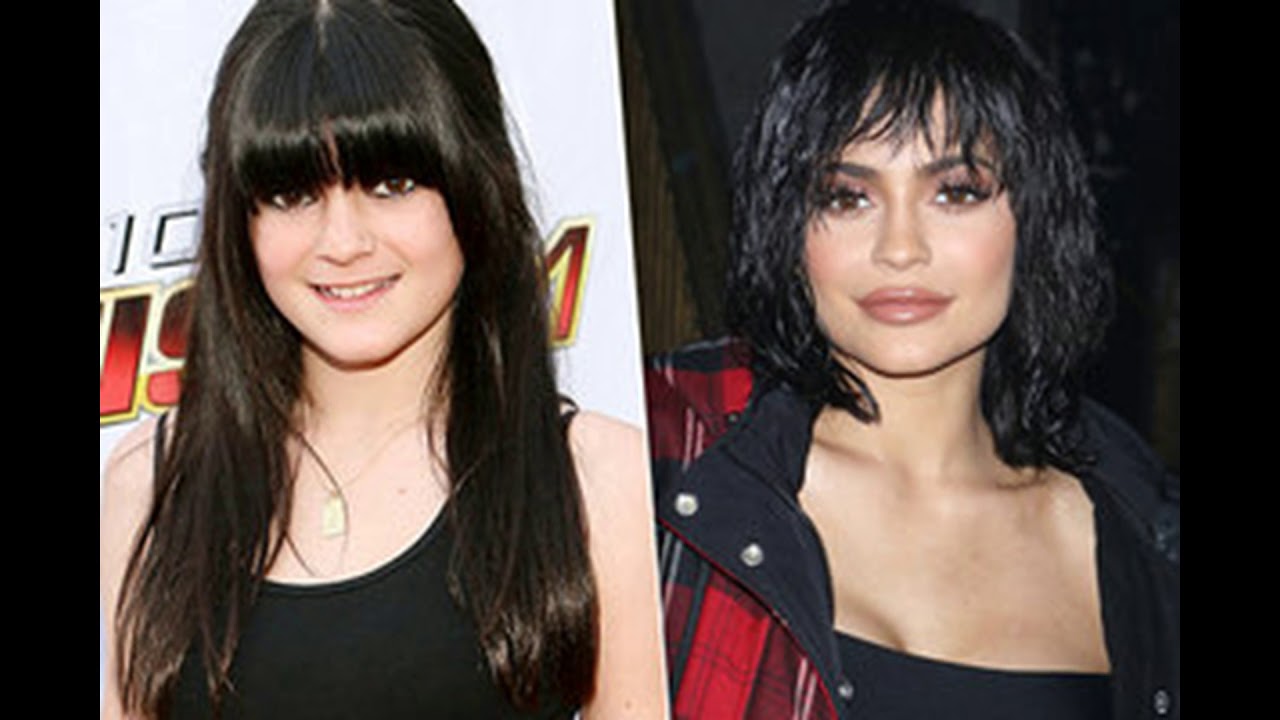 КАЙЛИ ДЖЕННЕР ДО ПЛАСТИКИ /Kylie Jenner /СМОТРЕТЬ ВСЕМ!!