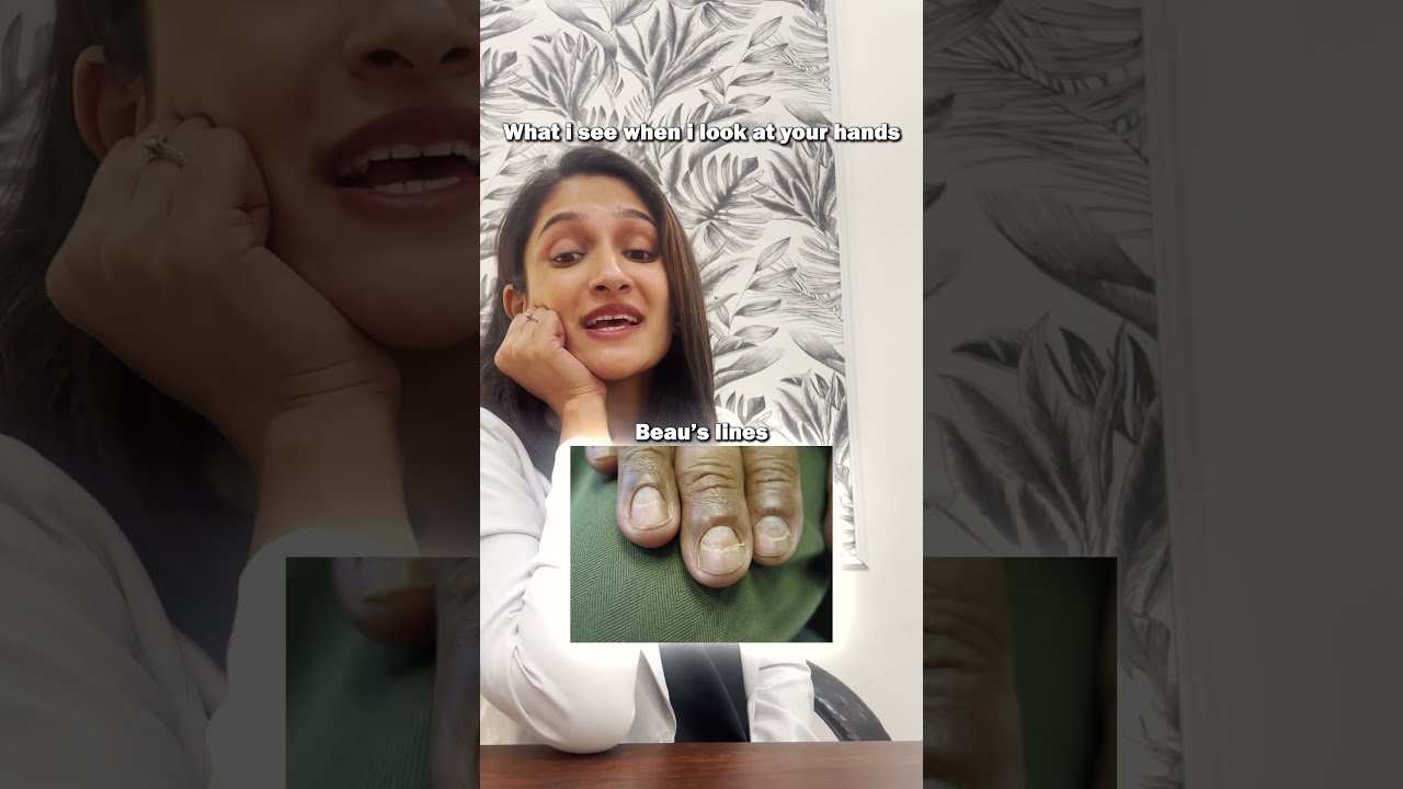 WHAT I SEE WHEN YOUR NAILS Dr Tanvi Vaidya