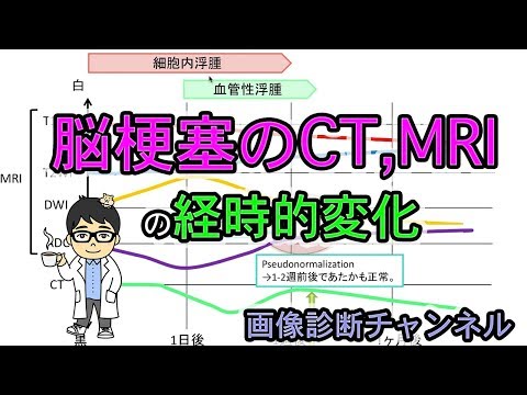脳梗塞のCT、MRIの経時的変化【救急画像読影の基礎】