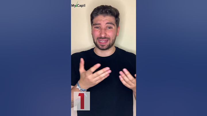 ❌ 5 ERRORES AL USAR MINOXIDIL🚫